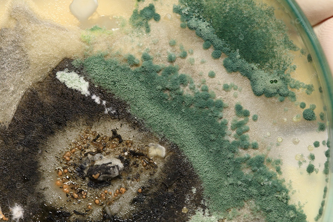 Microscópio fungos bactérias