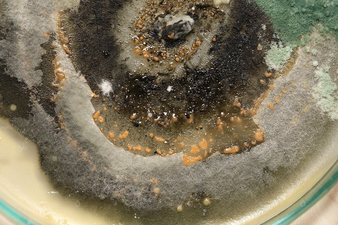 Microscópio fungos bactérias