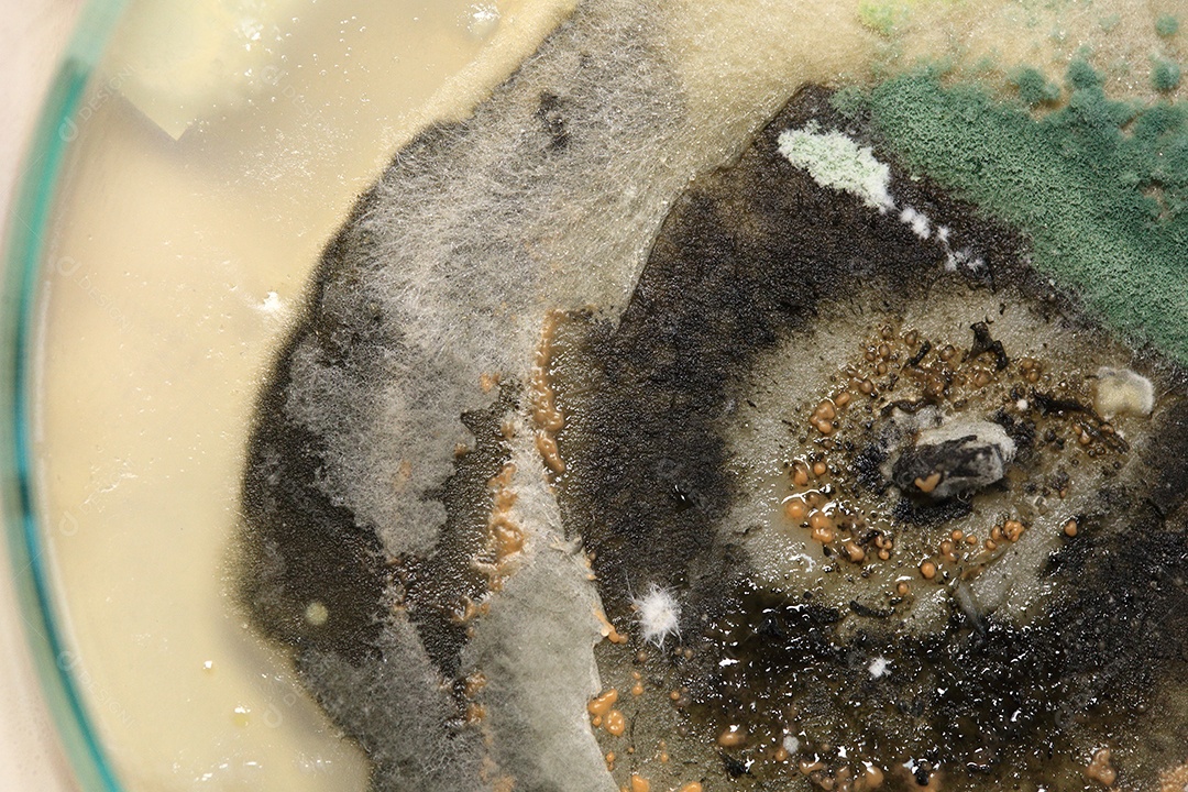 Microscópio fungos bactérias