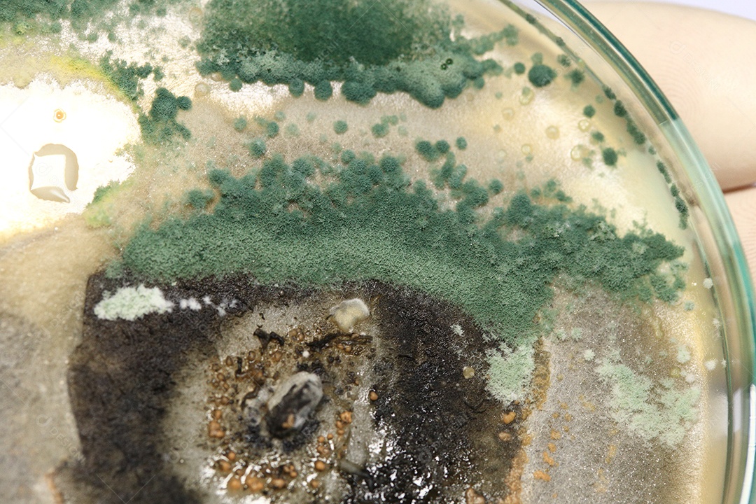 Microscópio fungos bactérias