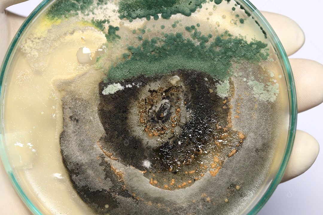 Microscópio fungos bactérias