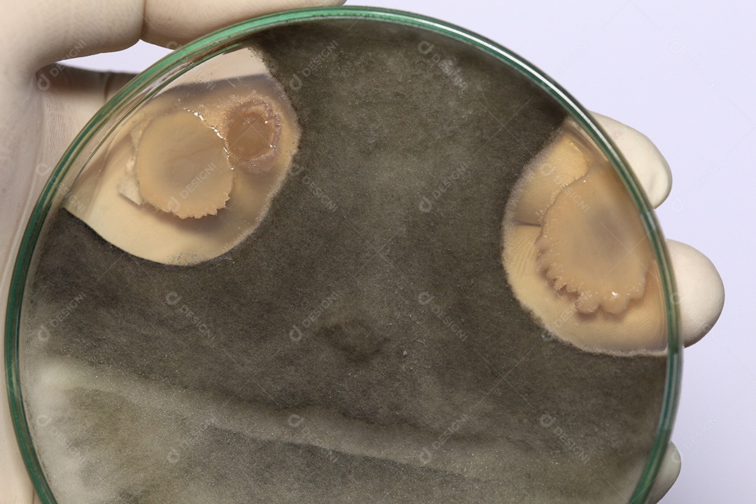 Microscópio fungos bactérias