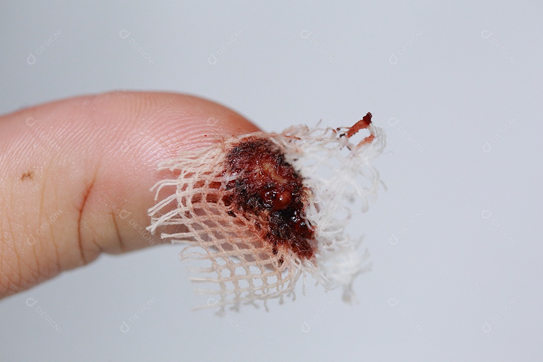 Close-up vista do dedo na mão humana do polegar esquerdo é cortado ferido.