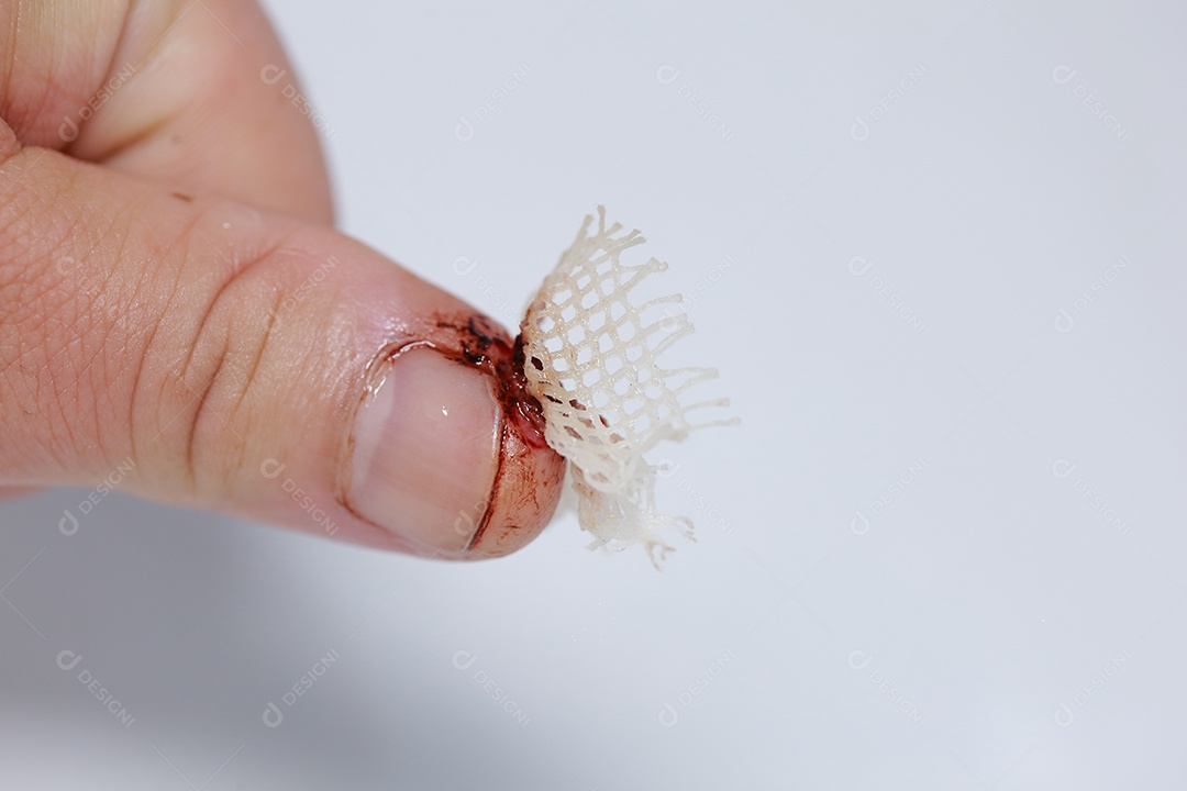 Close-up vista do dedo na mão humana do polegar esquerdo é cortado ferido.