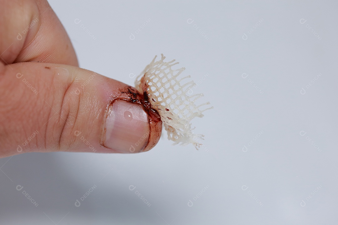 Close-up vista do dedo na mão humana do polegar esquerdo é cortado ferido.