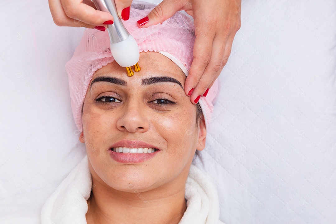 Aplicação de radiofrequência facial para tratamento de melasma