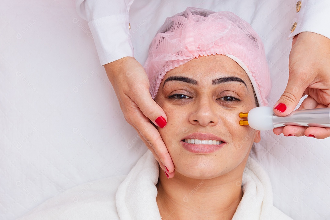 Aplicação de radiofrequência facial para tratamento de melasma