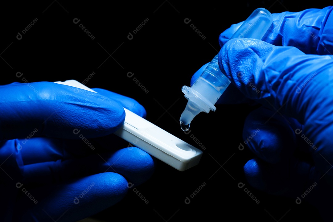 Mão de pessoal médico colocando a amostra de secreções no SA