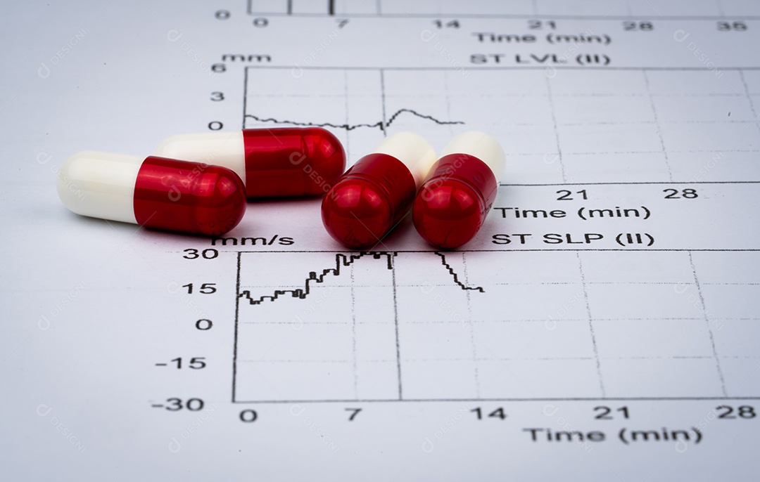 EKG ou ECG (Eletrocardiograma) papel de relatório gráfico.