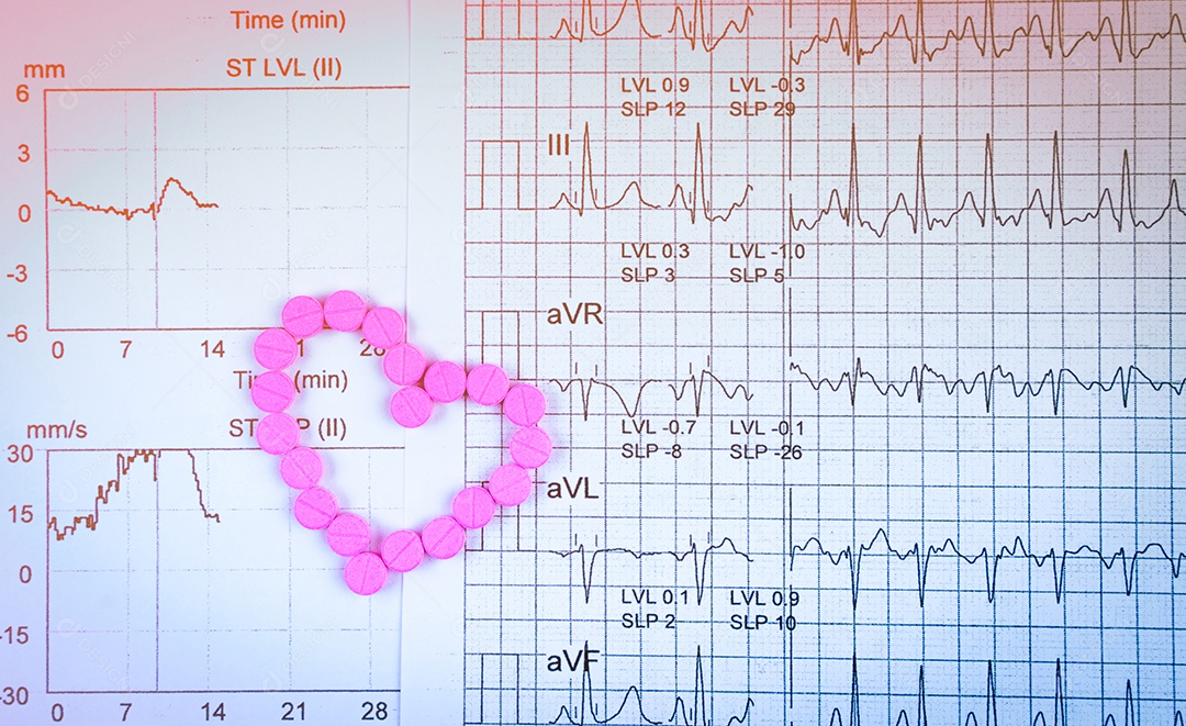 EKG ou ECG (Eletrocardiograma) papel de relatório gráfico.