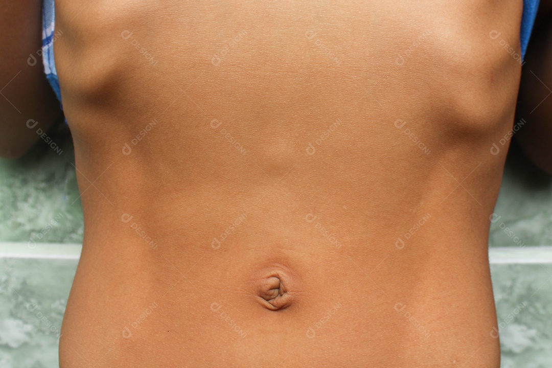 Criança mostrando sua hérnia epigástrica. Hérnia intestinal. Hérnia abdominal.