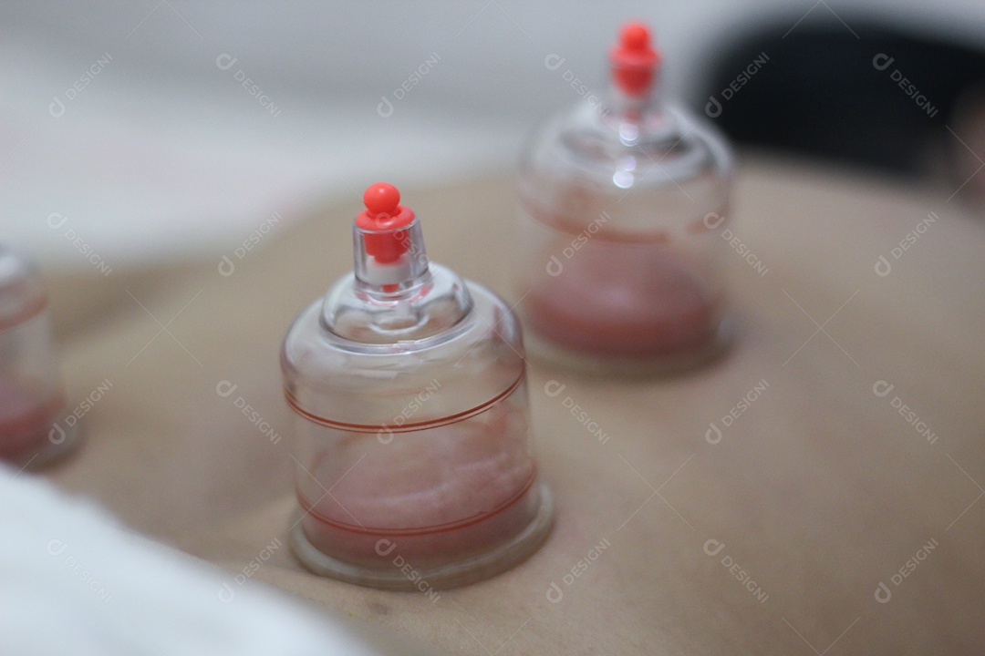 Procedimentos estéticos sendo praticando com pessoa