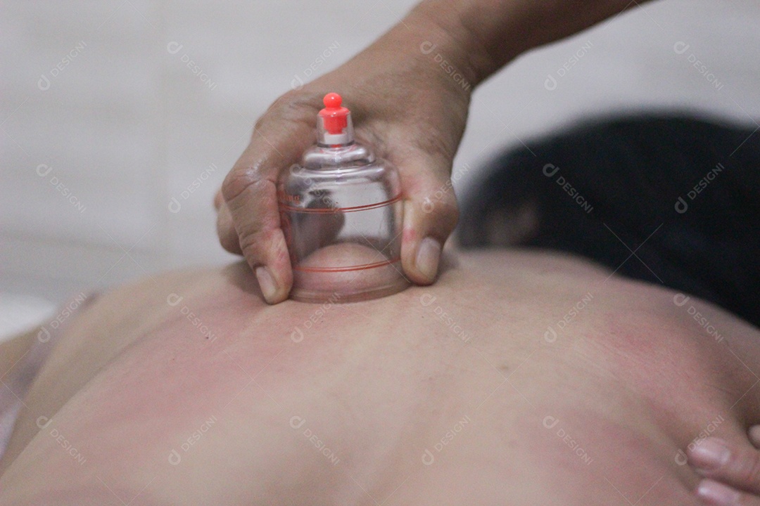 Procedimentos estéticos sendo praticando com pessoa