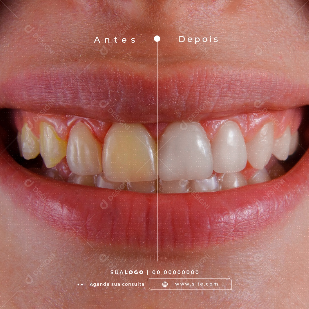 Social Media Dentista Odontologia PSD Editável