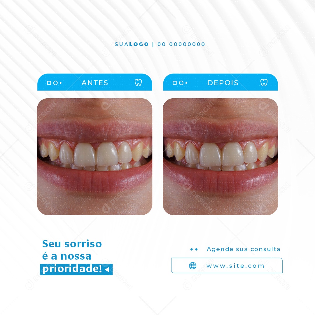 Social Media Dentista Seu Sorriso é a nossa Prioridade PSD Editável