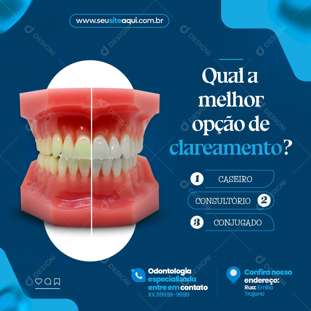 Post Dentista Qual é A Melhor Opção De Clareamento Social Media PSD Editável