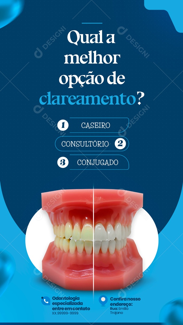 Post Dentista Qual é A Melhor Opção De Clareamento Social Media PSD Editável