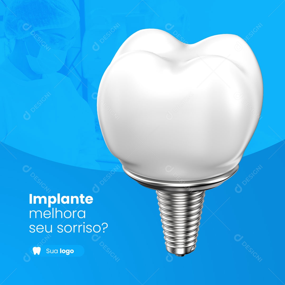 Implante Melhora seu Sorriso? Consultório Odontológicos Dentista Social Media PSD Editável