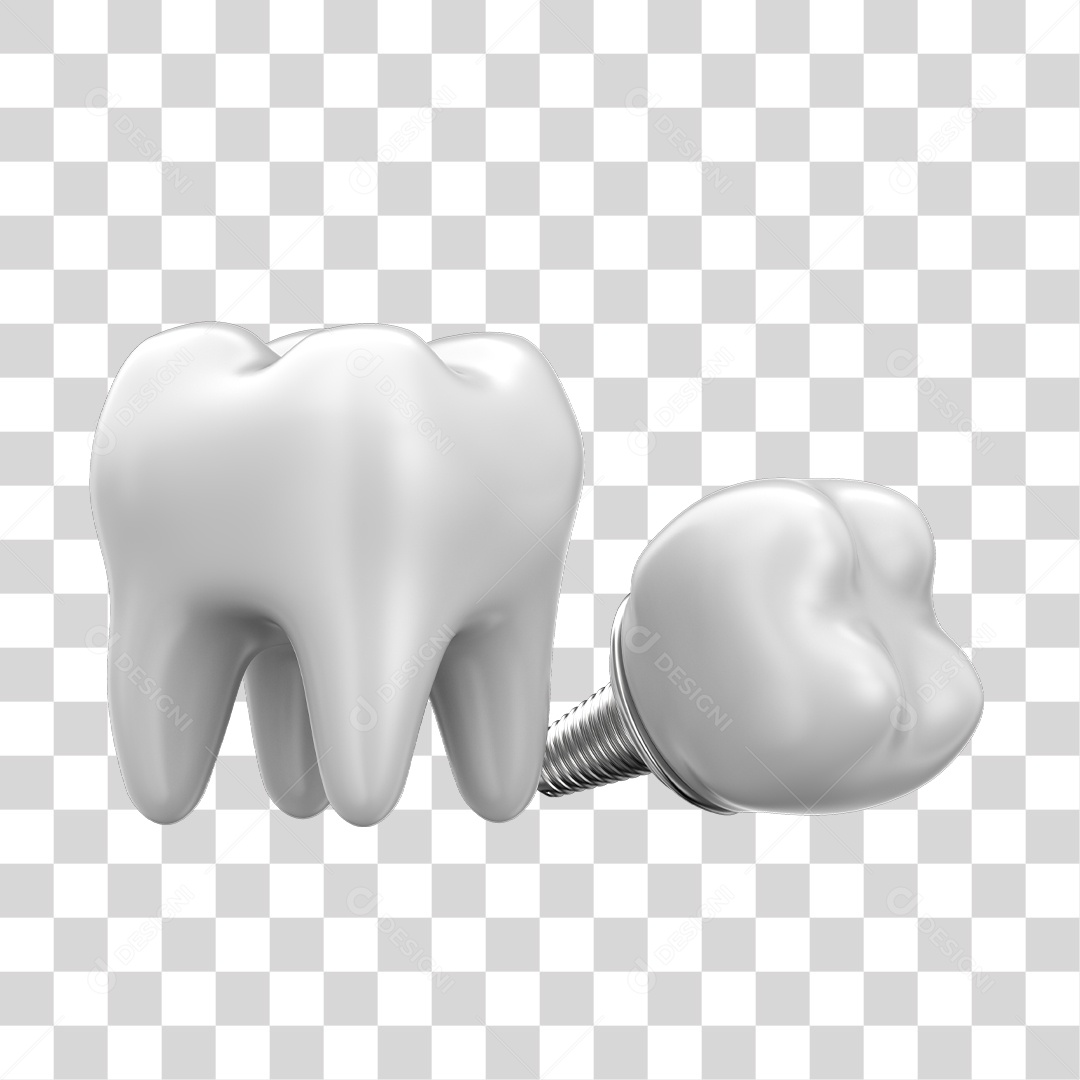 Dente Branco Implante Elemento 3D PNG Transparente