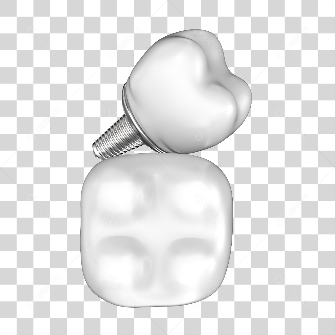 Dente Branco Implante Elemento 3D PNG Transparente