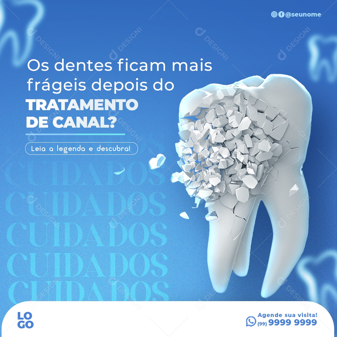 Os Dentes Ficam Mais Frágeis Depois De Tratamento De Canal Social Media PSD Editável
