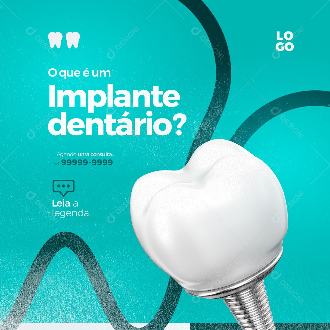 O que é um Implante Dentário? Consultório Odontológicos Dentista Social Media PSD Editável