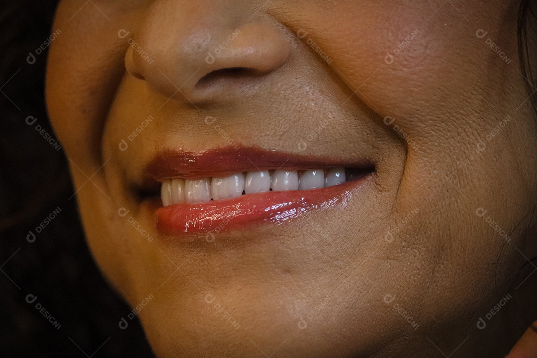 Mulher madura sorrindo com lentes de clareamento dental