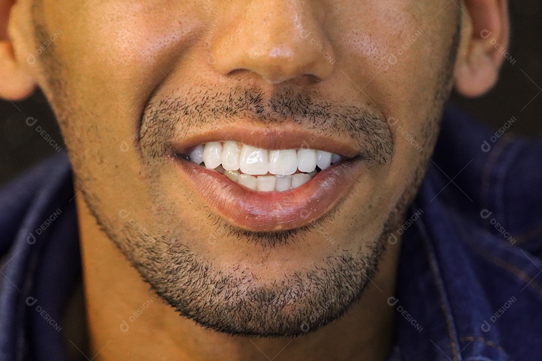 Homem moreno sorrindo com lentes de clareamento dental