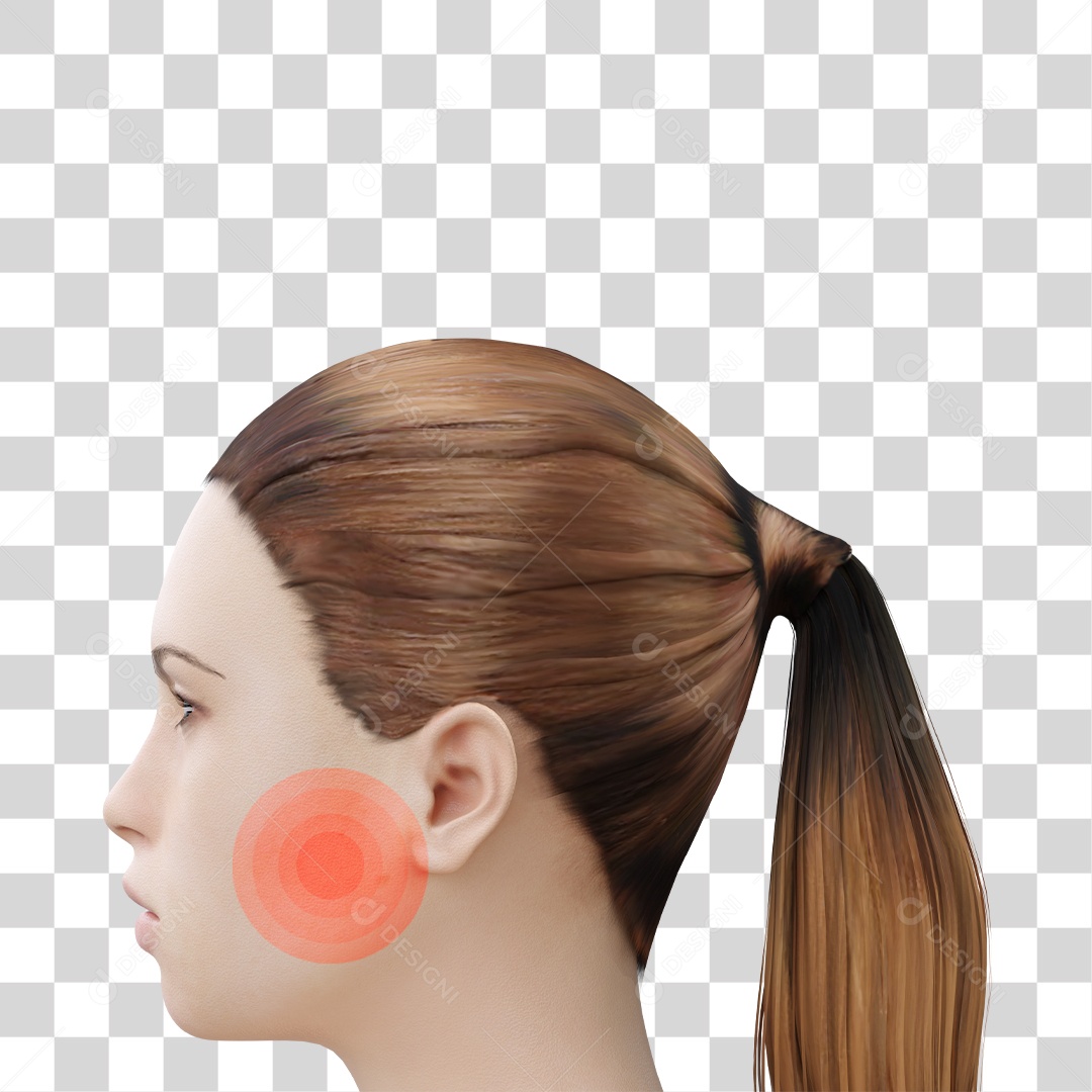 Distúrbios da Articulação Temporomandibular PSD + PNG