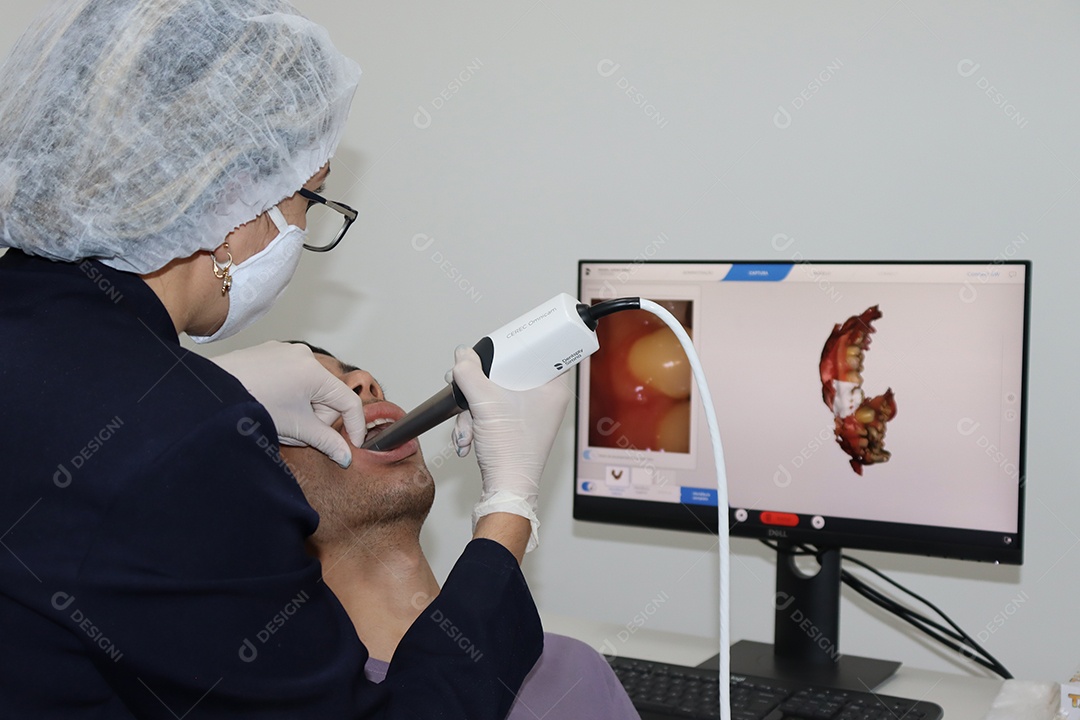 Clinica de Odontologia, dentista fazendo molde dos dentes