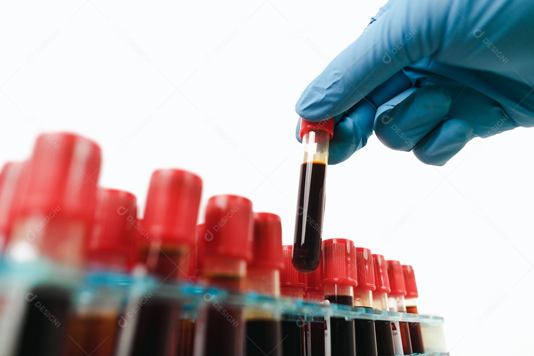 Um tubo de amostra de sangue com tampa vermelha está na mão