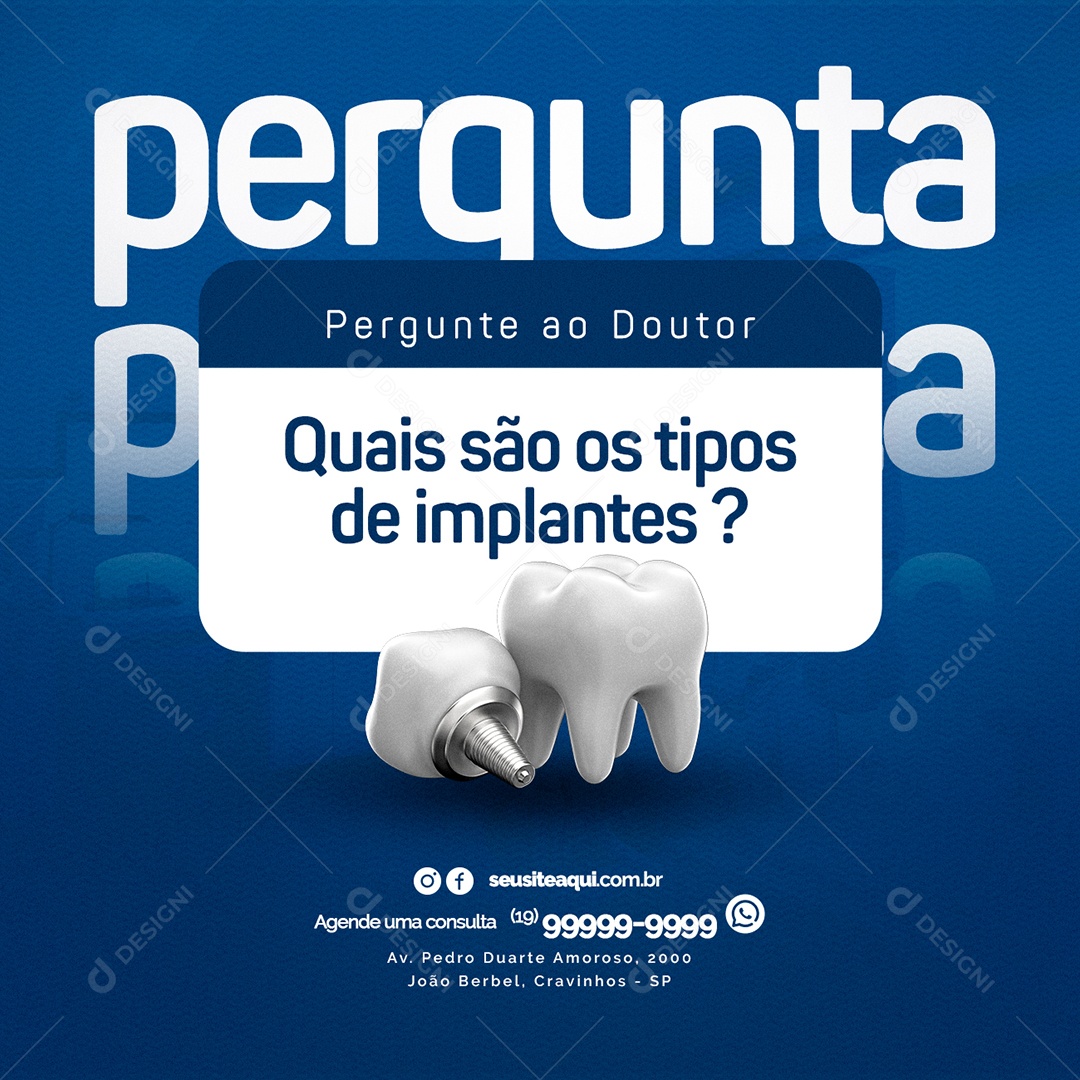 Quais os Tipos de Implantes Clínica Odontológica Social Media PSD Editável