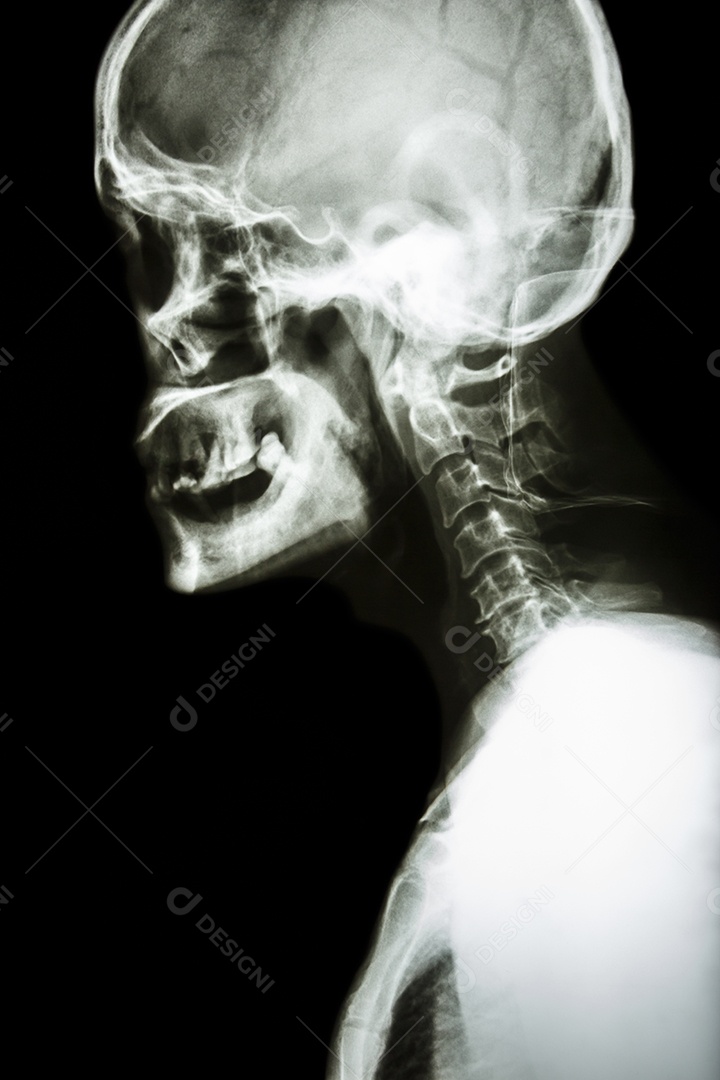 Crânio e coluna cervical humanos normais