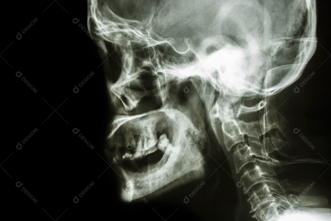 Crânio humano e área em branco no lado esquerdo