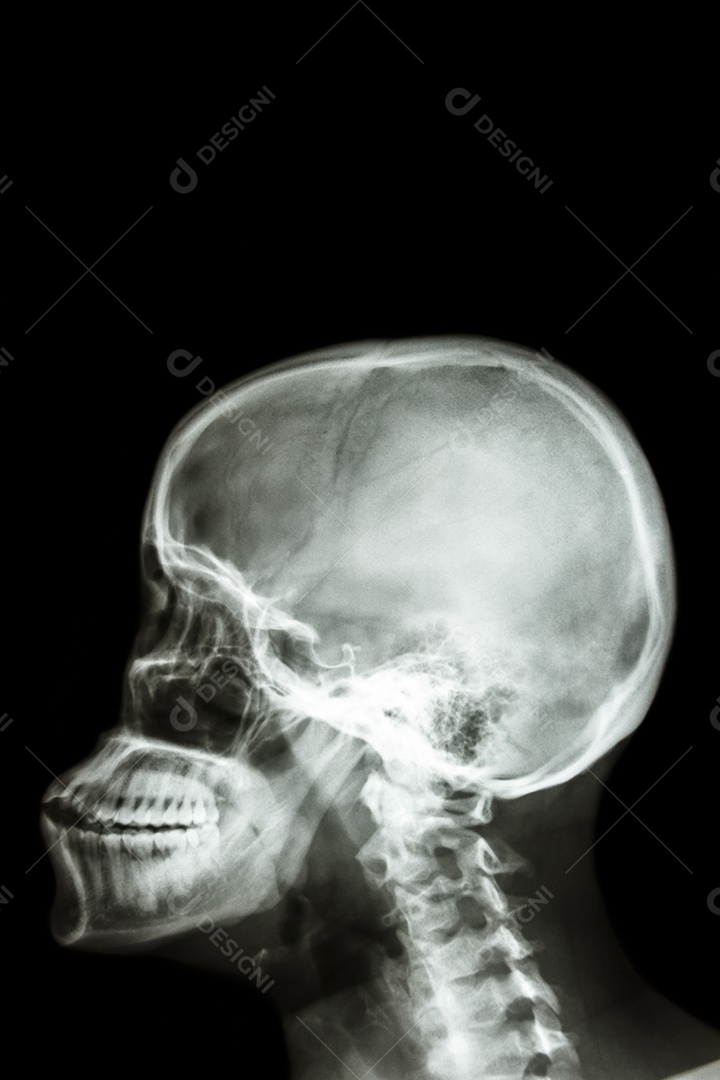 Crânio humano e área em branco na parte superior para preencher o texto