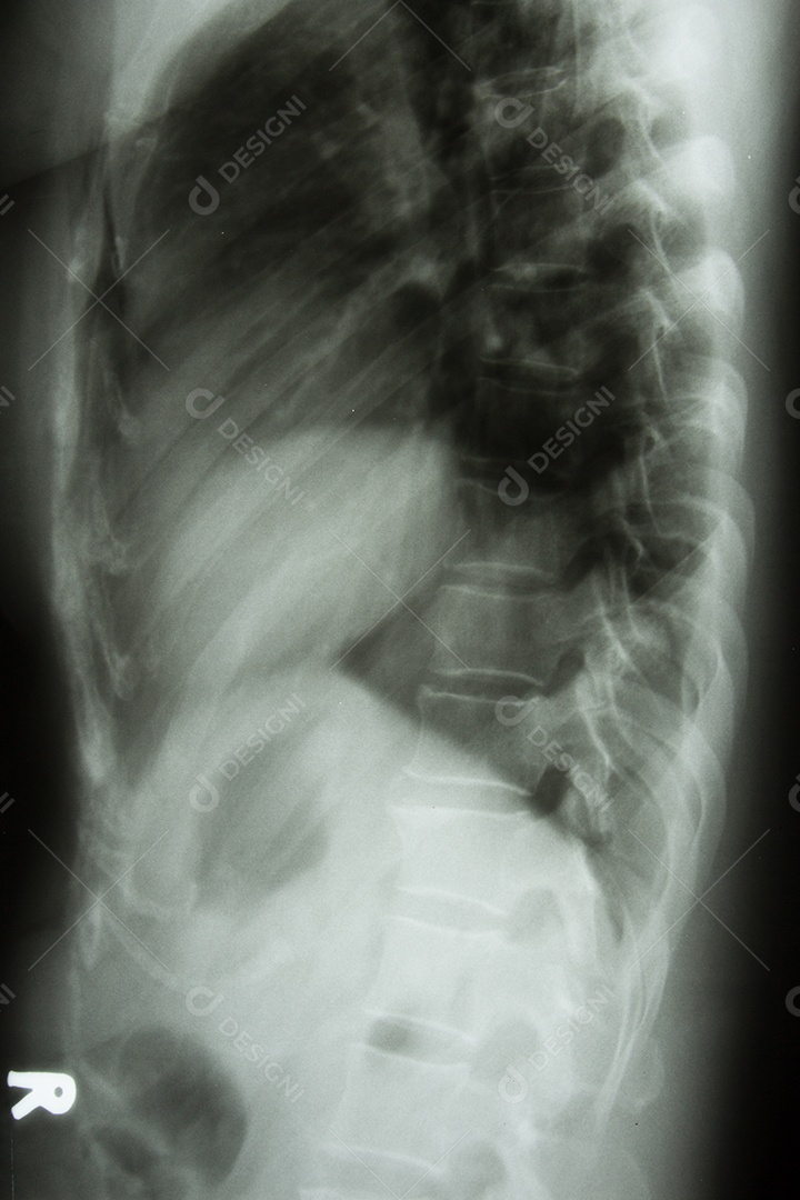 Raio x exame completo