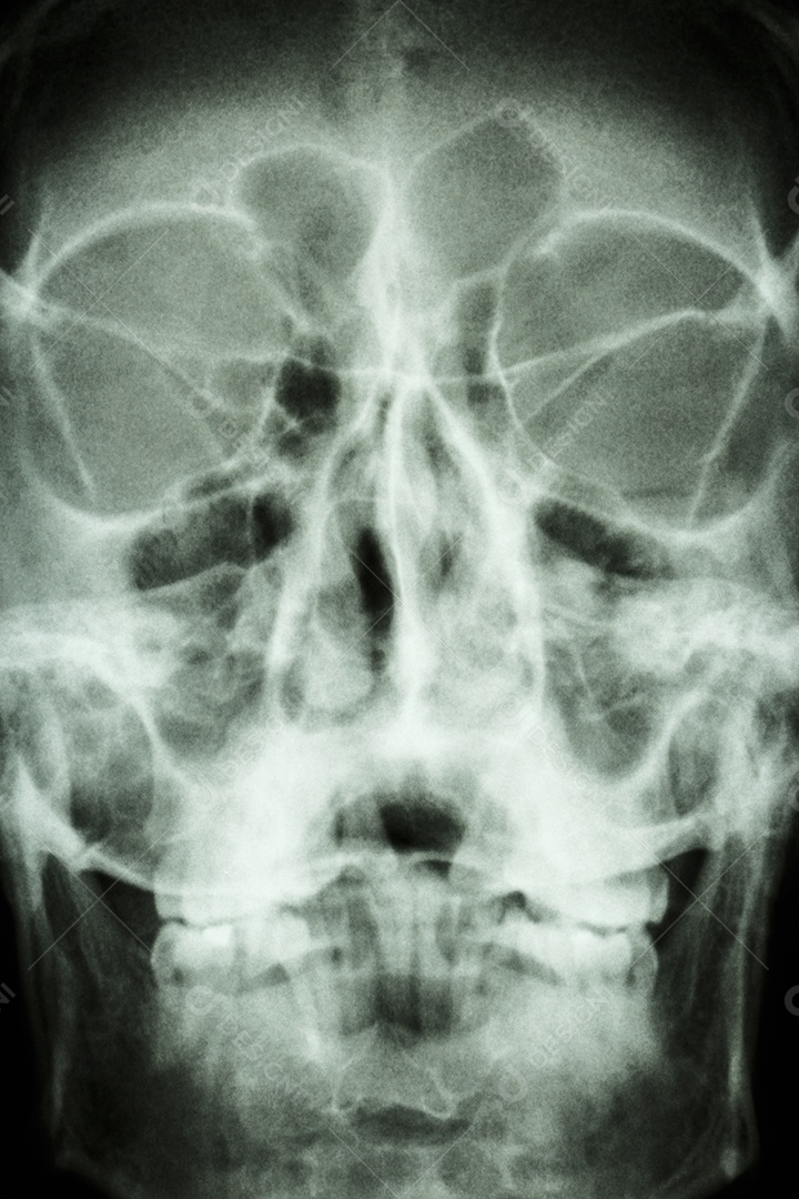 É possível ver a estrutura do crânio