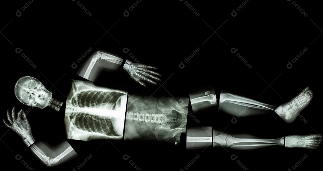Esqueleto humano deitado imagem através de um raio x