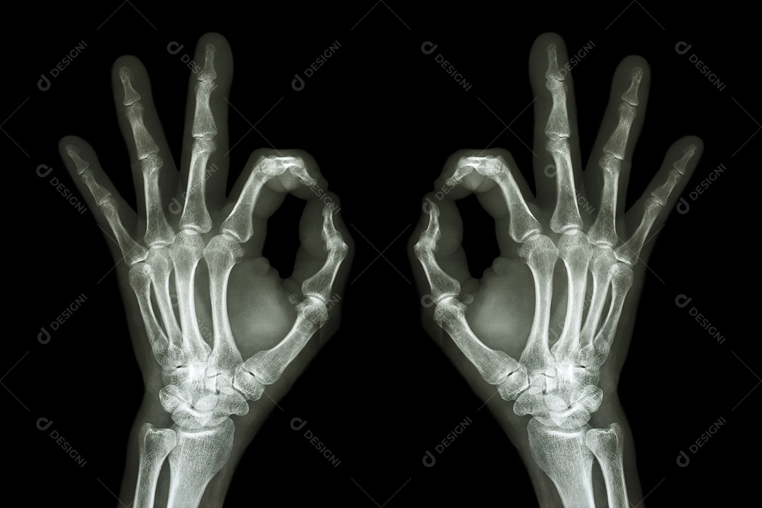 Raio x de mão com símbolo OK