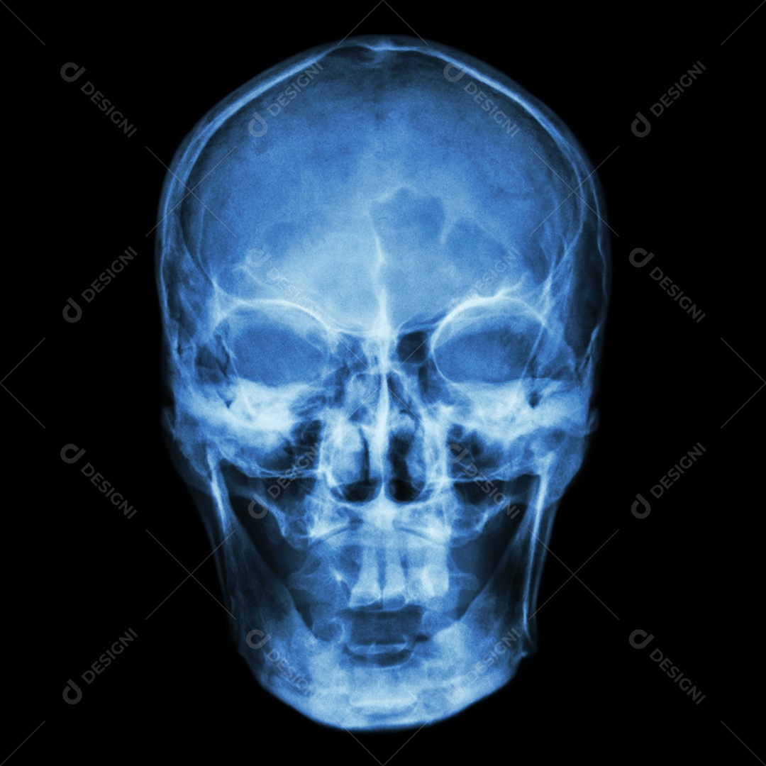 Raio X de crânio asiático normal