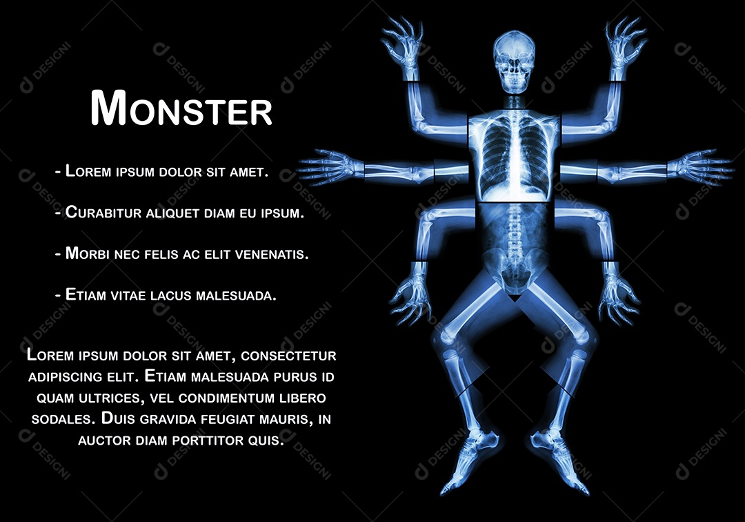 O monstro tem muitos braços.raio X de corpo inteiro