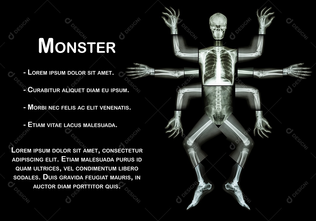 O monstro tem muitos braços.raio X de corpo inteiro