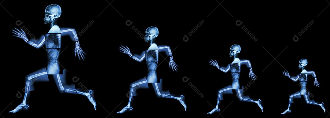 Radiografia de corpo inteiro