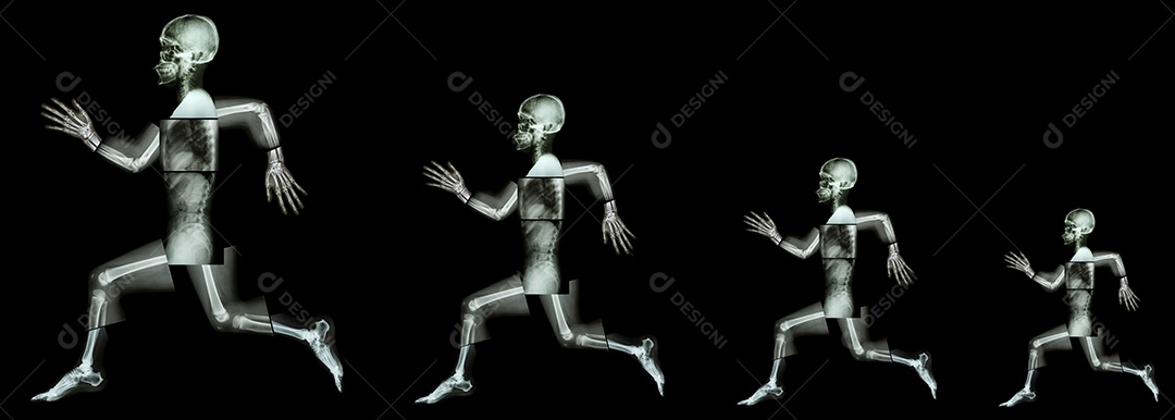 Radiografia de corpo inteiro