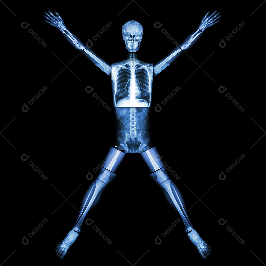 Pare a tuberculose osso humano levante a mão corpo inteiro