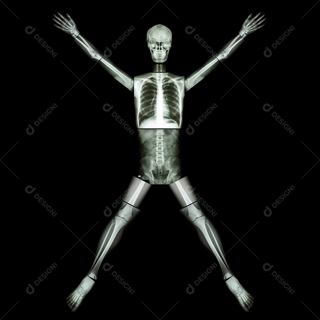 Pare a tuberculose osso humano levante a mão corpo inteiro