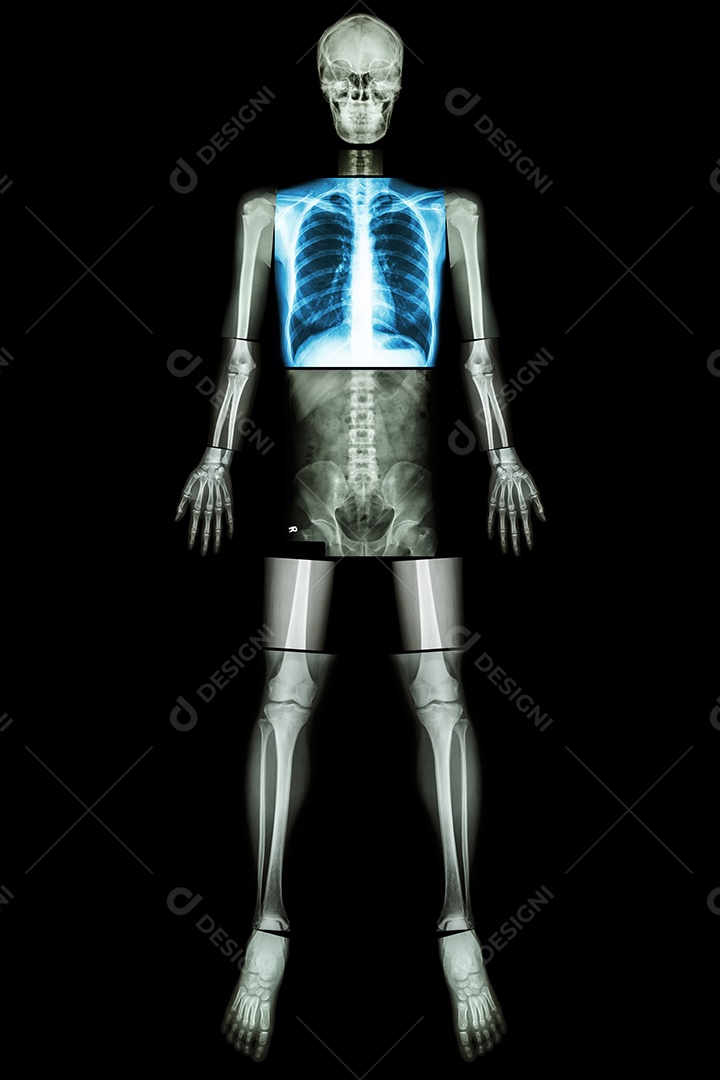 Pulmão saudável raio x corpo inteiro