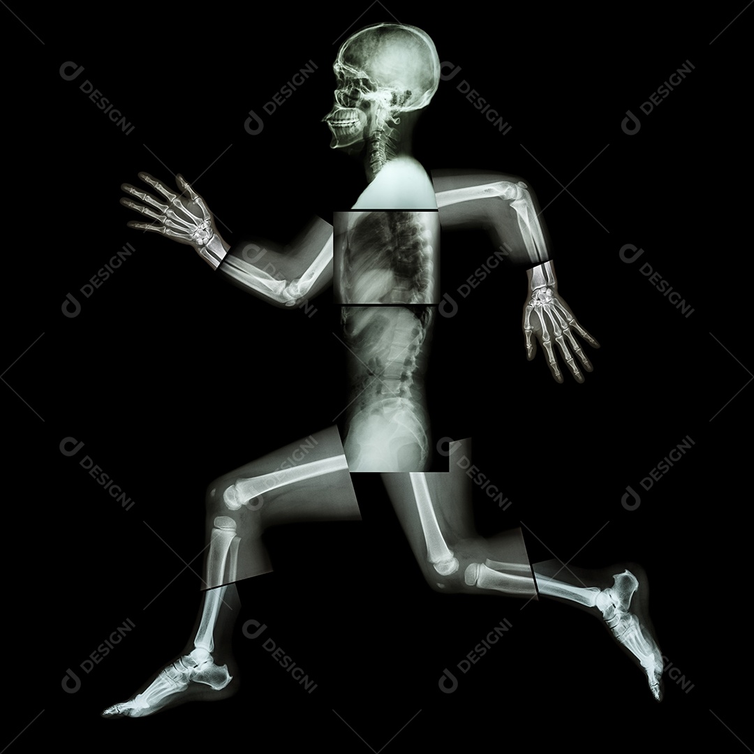 Exercício aeróbico osso humano em execução radiografia de corpo inteiro