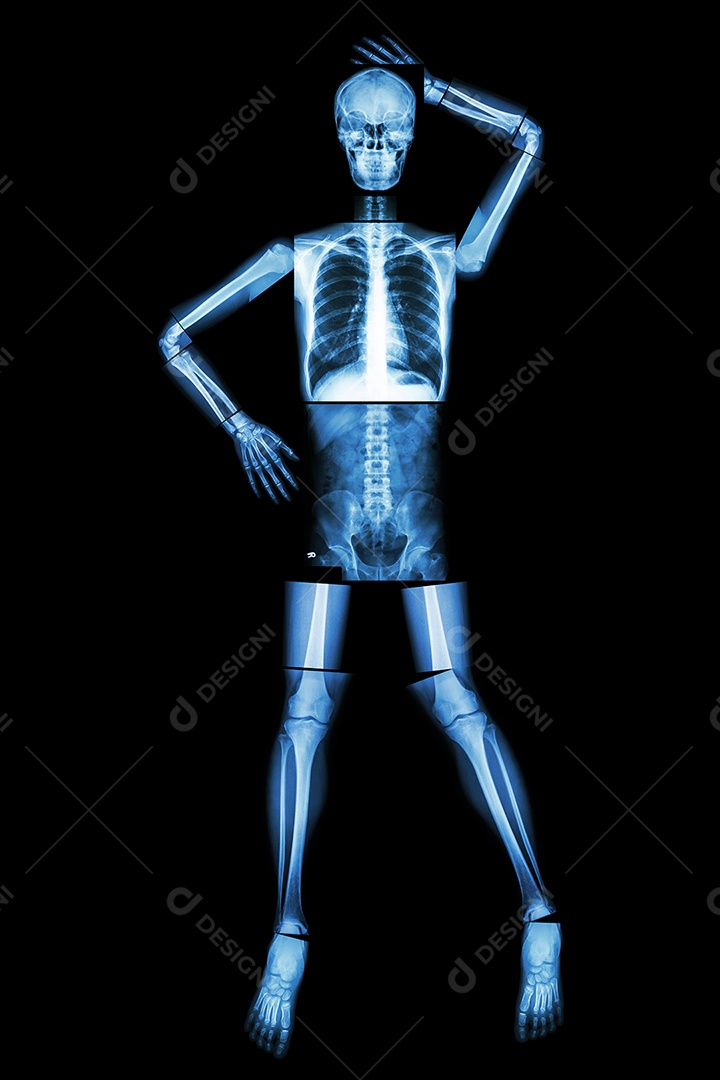 Osso humano em pé e na cintura raio X de corpo inteiro