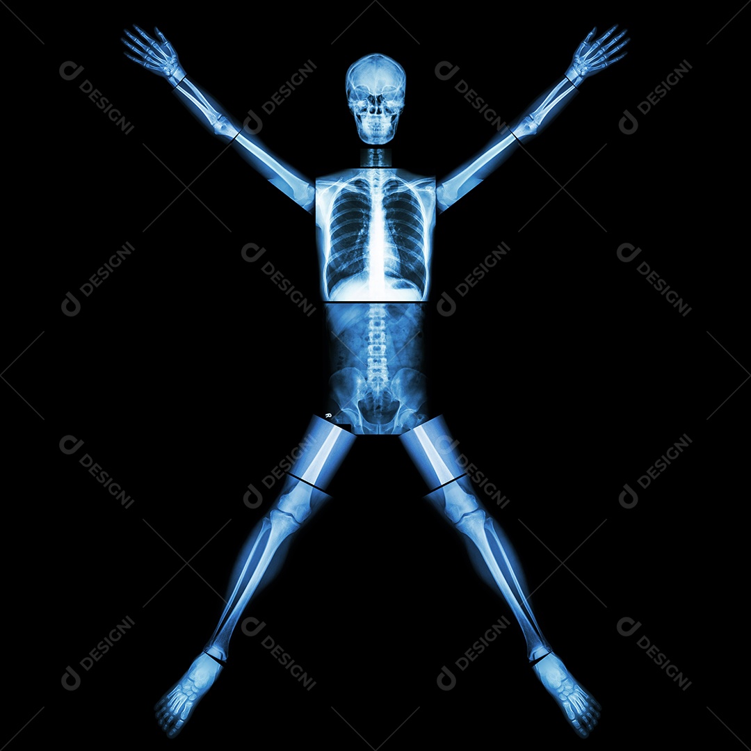 Pare a tuberculose osso humano levante a mão corpo inteiro